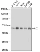 Anti-RCC1 antibody used in Western Blot (WB). GTX64560