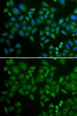 Anti-ASM antibody used in Immunocytochemistry/ Immunofluorescence (ICC/IF). GTX64562