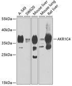 Anti-HSD3a antibody used in Western Blot (WB). GTX64564