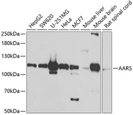 Anti-alanyl-tRNA synthetase antibody used in Western Blot (WB). GTX64565