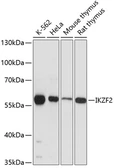 Anti-HELIOS antibody used in Western Blot (WB). GTX64570