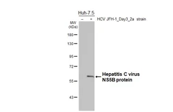 Anti-Hepatitis C virus NS5B protein antibody [HL5271] used in Western Blot (WB). GTX645709