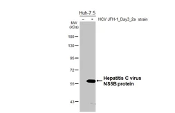 Anti-Hepatitis C virus NS5B protein antibody [HL5277] used in Western Blot (WB). GTX645715