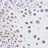 Anti-SART1 antibody used in Immunoprecipitation (IP). GTX64573