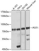 Anti-POT1 antibody used in Western Blot (WB). GTX64574