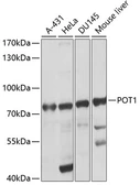 Anti-POT1 antibody used in Western Blot (WB). GTX64574