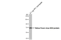 Anti-Yellow Fever virus NS3 protein antibody [GT344] used in Western Blot (WB). GTX645756