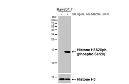 Anti-Histone H3S28ph (phospho Ser28) antibody [HL5300] used in Western Blot (WB). GTX645765