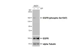 Anti-EGFR (phospho Ser1047) antibody [HL5304] used in Western Blot (WB). GTX645769