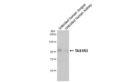 Anti-TAS1R3 antibody [HL5310] used in Western Blot (WB). GTX645775