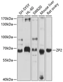 Anti-ZP2 antibody used in Western Blot (WB). GTX64579