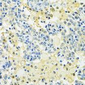 Anti-SLC25A1 antibody used in IHC (Paraffin sections) (IHC-P). GTX64580