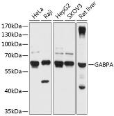 Anti-GABPA antibody used in Western Blot (WB). GTX64581
