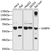 Anti-GABPA antibody used in Western Blot (WB). GTX64581