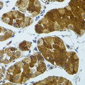 Anti-CETP antibody used in IHC (Paraffin sections) (IHC-P). GTX64582