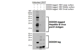 Anti-Hepatitis B virus preS1 antibody [HL5350] used in Western Blot (WB). GTX645828