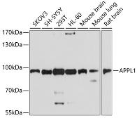 Anti-APPL1 antibody used in Western Blot (WB). GTX64585