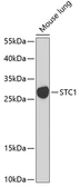 Anti-Stanniocalcin 1 antibody used in Western Blot (WB). GTX64588