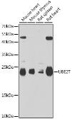 Anti-UBE2T antibody used in Western Blot (WB). GTX64589
