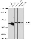 Anti-DFNA5 antibody used in Western Blot (WB). GTX64590