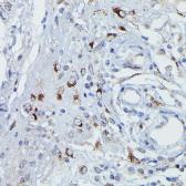 Anti-DFNA5 antibody used in IHC (Paraffin sections) (IHC-P). GTX64590