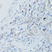 Anti-DFNA5 antibody used in IHC (Paraffin sections) (IHC-P). GTX64590