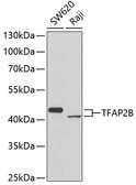 Anti-AP2 beta antibody used in Western Blot (WB). GTX64592