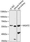 Anti-MGAT2 antibody used in Western Blot (WB). GTX64595
