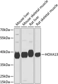 Anti-HOXA13 antibody used in Western Blot (WB). GTX64598