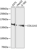 Anti-COL11A2 antibody used in Western Blot (WB). GTX64599