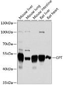 Anti-GPT antibody used in Western Blot (WB). GTX64602