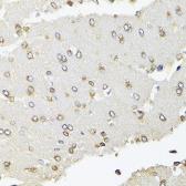 Anti-RPB2 antibody used in IHC (Paraffin sections) (IHC-P). GTX64604