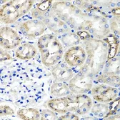 Anti-TSG6 antibody used in IHC (Paraffin sections) (IHC-P). GTX64605