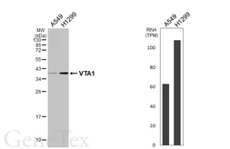 Anti-VTA1 antibody [HL5428] used in Western Blot (WB). GTX646070