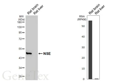 Anti-NSE antibody [HL5436] used in Western Blot (WB). GTX646078