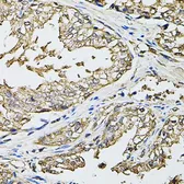 Anti-NORE1 antibody used in IHC (Paraffin sections) (IHC-P). GTX64609