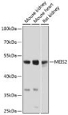 Anti-MEIS2 antibody used in Western Blot (WB). GTX64612