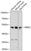 Anti-MEIS2 antibody used in Western Blot (WB). GTX64612
