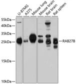 Anti-RAB27B antibody used in Western Blot (WB). GTX64615