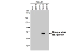 Anti-Dengue virus NS3 protein antibody [HL5510] used in Western Blot (WB). GTX646174