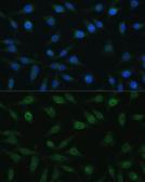 Anti-NUP98 antibody used in Immunocytochemistry/ Immunofluorescence (ICC/IF). GTX64618