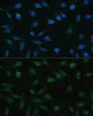 Anti-NUP98 antibody used in Immunocytochemistry/ Immunofluorescence (ICC/IF). GTX64618