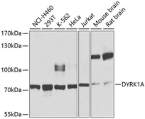 Anti-DYRK1A antibody used in Western Blot (WB). GTX64619