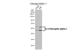 Anti-IL13 Receptor alpha 1 antibody [HL5529] used in Western Blot (WB). GTX646192