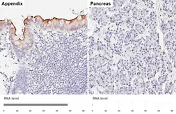Anti-CEACAM7 antibody [HL5532] used in IHC (Paraffin sections) (IHC-P). GTX646195