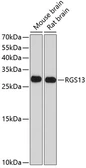 Anti-RGS13 antibody used in Western Blot (WB). GTX64621