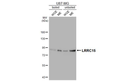 Anti-LRRC15 antibody [HL5542] used in Western Blot (WB). GTX646216