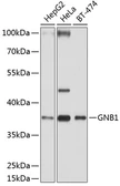 Anti-GNB1 antibody used in Western Blot (WB). GTX64622