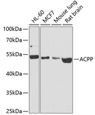 Anti-Prostatic Acid Phosphatase antibody used in Western Blot (WB). GTX64623