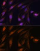 Anti-UBE2S antibody used in Immunocytochemistry/ Immunofluorescence (ICC/IF). GTX64624